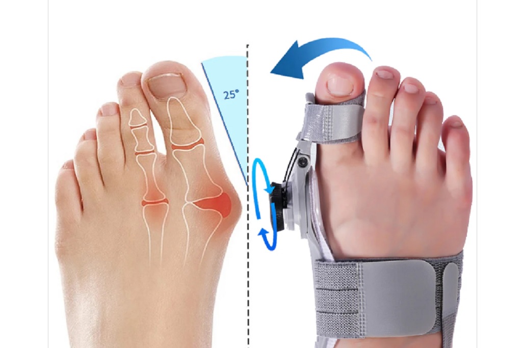 Treatmedy bunion