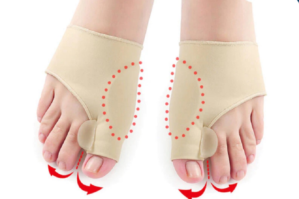 Hyggear Bunion Corrector