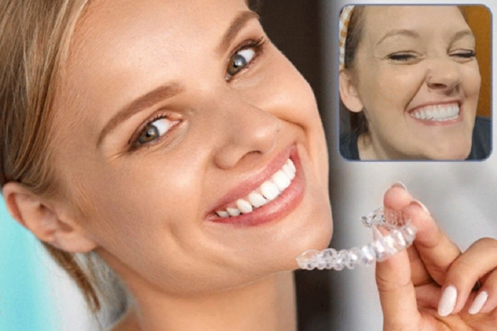 Nextwea denture