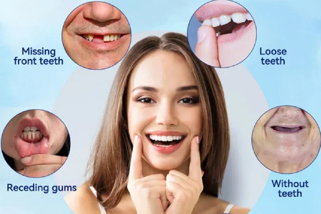 Aoyaanew Dentures